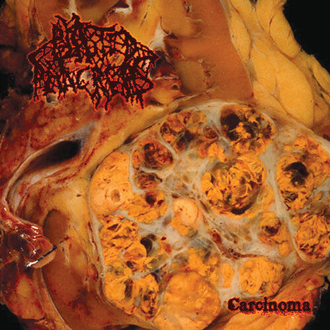 Blasted Pancreas - Carcinoma (Vinyl LP)